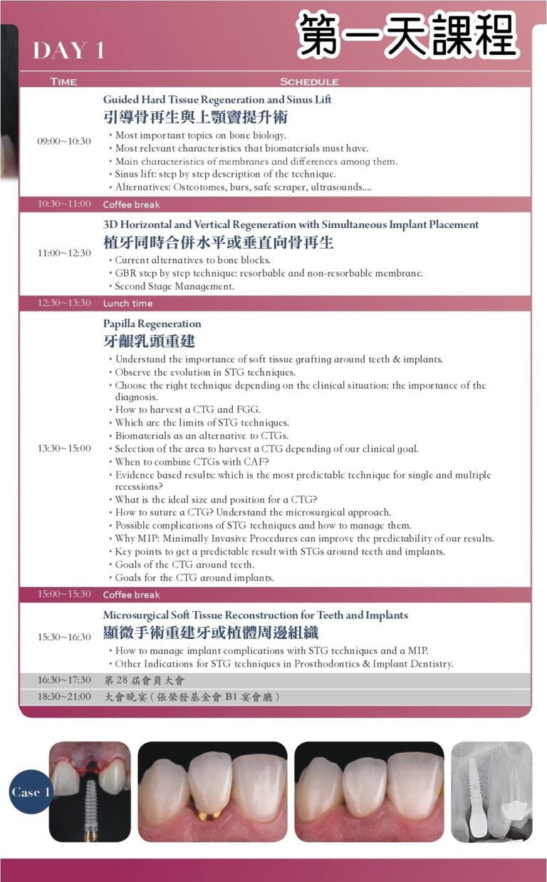 2020 年課程第 1 天議程，涵蓋骨再生、上顎竇提升及軟組織重建