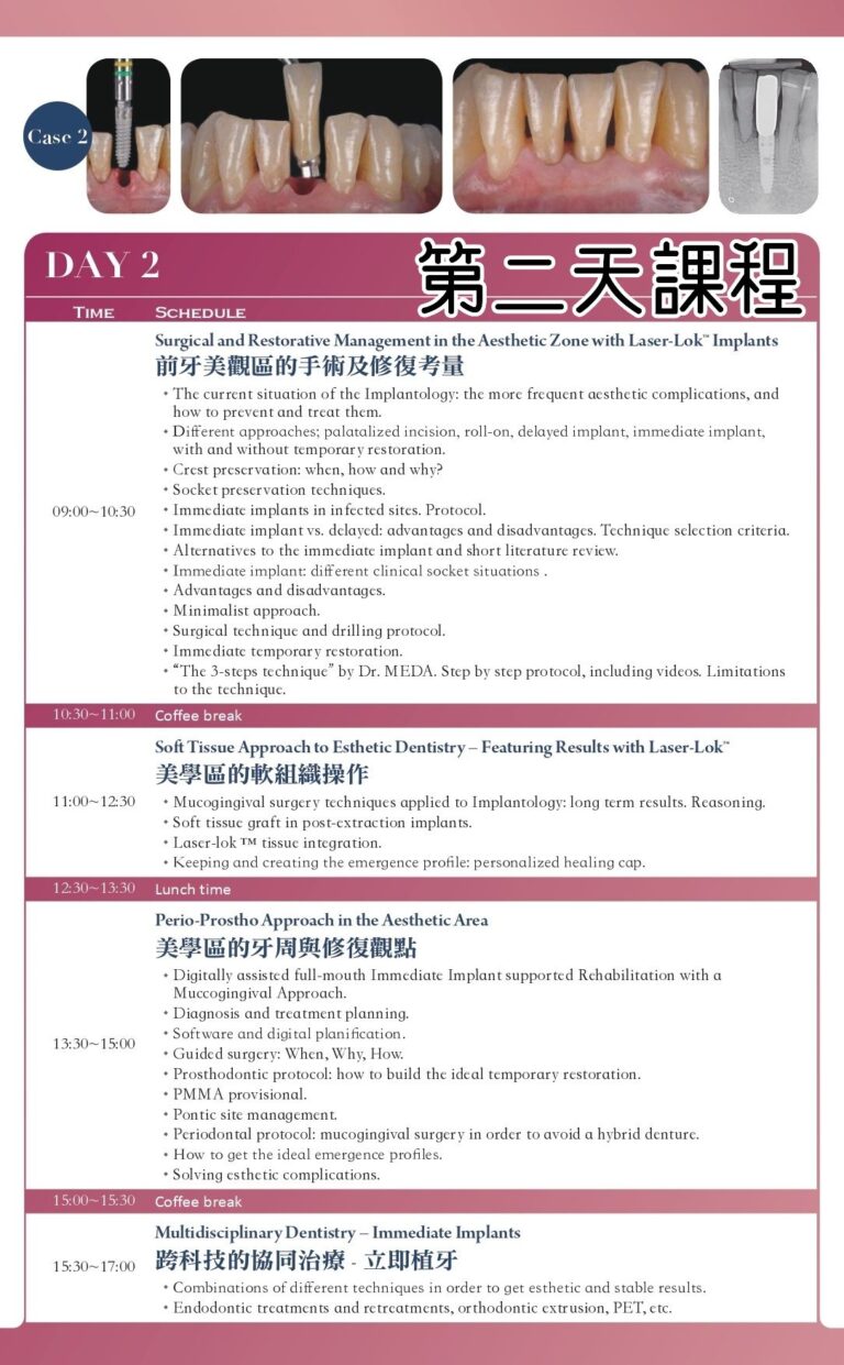 2020 年課程第 2 天議程，涵蓋美學區植牙及軟組織處理