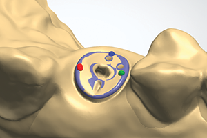 Smartshape workflow 3