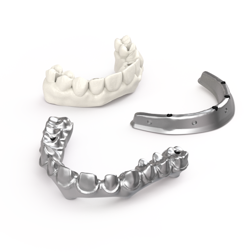 Vulcan Custom Dental 客製化全口贋復作品